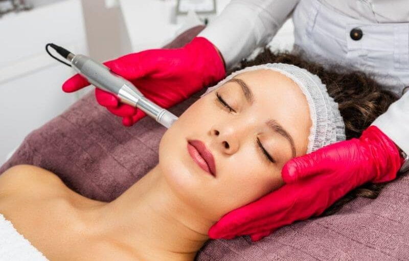 What Is Another Name for Microneedling?